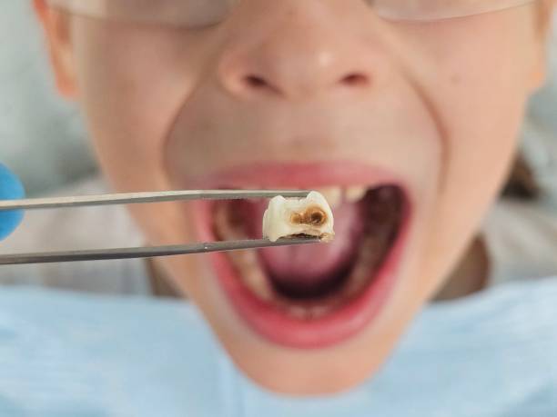 Best Urgent Tooth Repair  in La Grange Park, IL